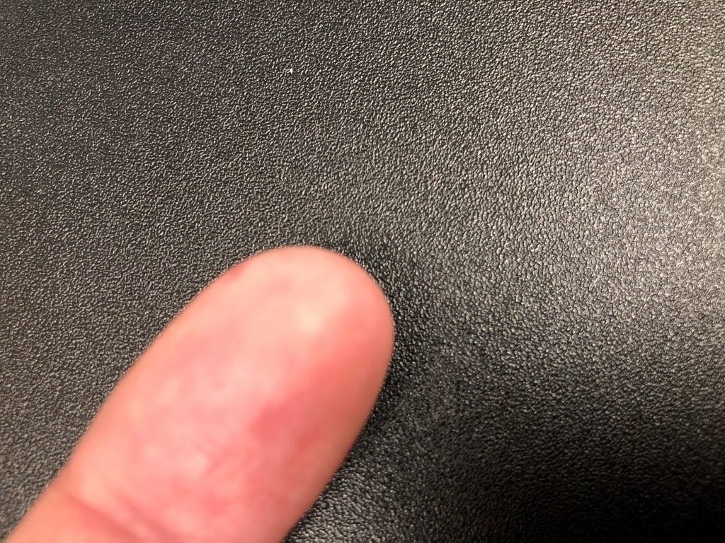 1553963978_14983130495c9f9bcaf2d3b1.25119373_finger.jpg