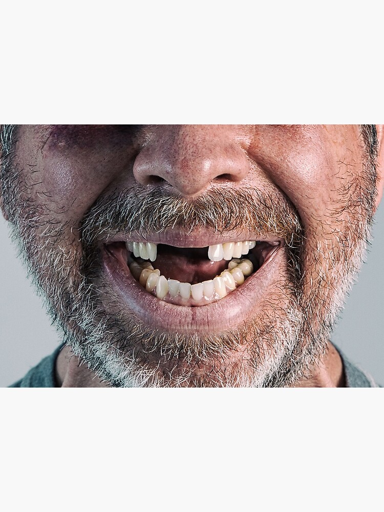 flat,750x,075,f-pad,750x1000,f8f8f8.jpg     hillbilly.jpg