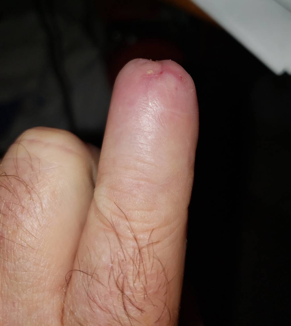 Healed.1651253325.jpg