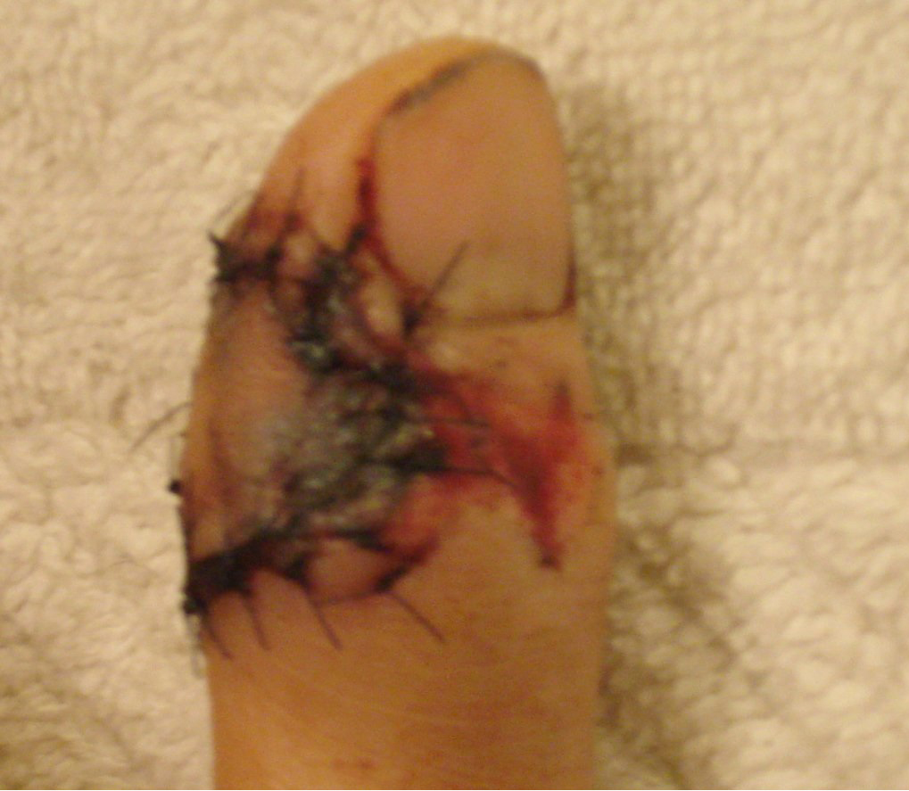 thumb_2.jpg