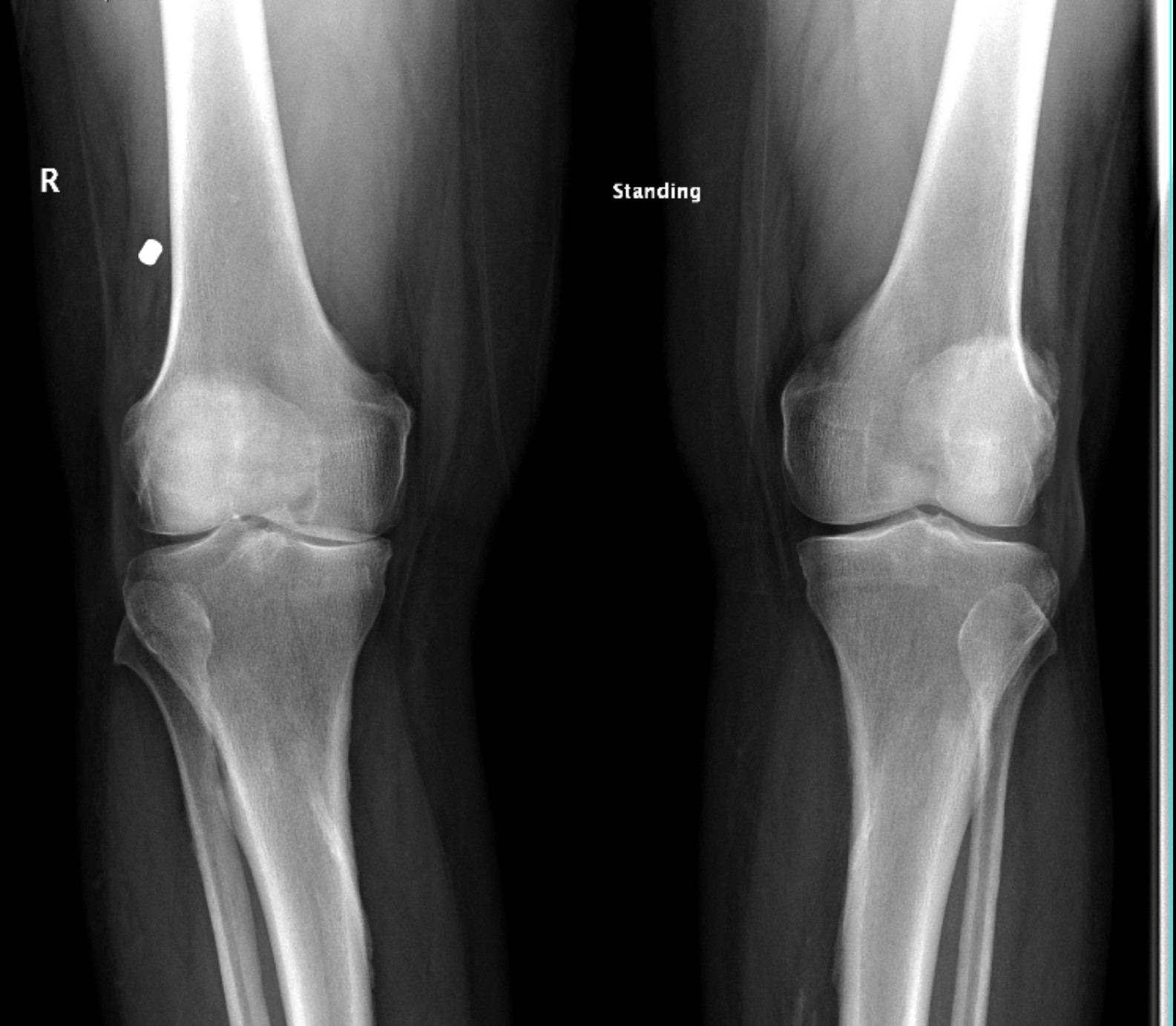 xray.jpg